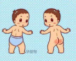 夏天穿紙尿褲真的會紅屁股嗎？